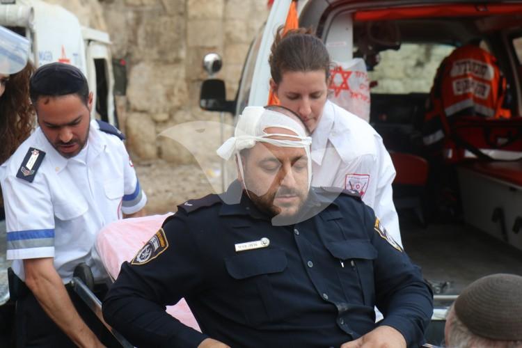 Injured Policeman by Stone Throwing Terrorist