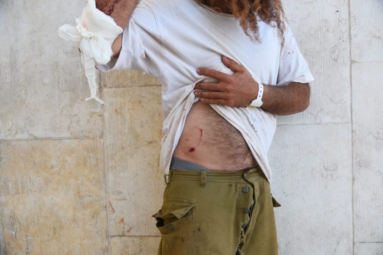 One of Four Israeli Shepherds wounded photo by tps